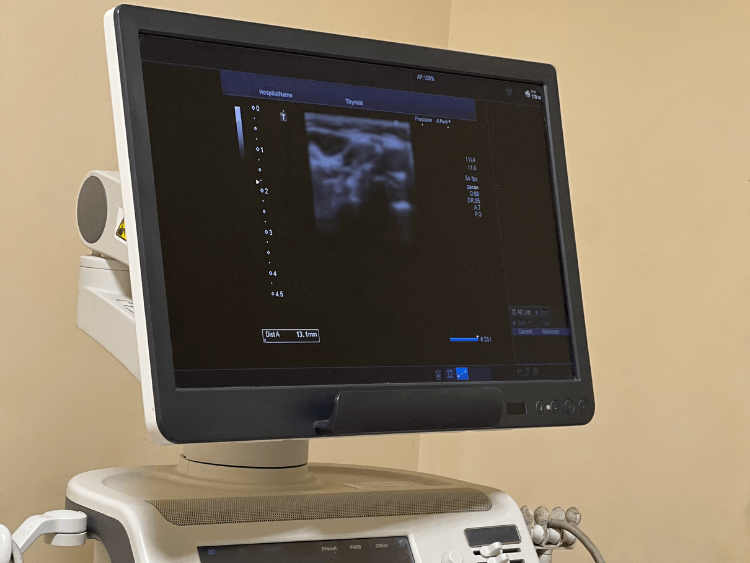 Ultrasonography and Color Doppler