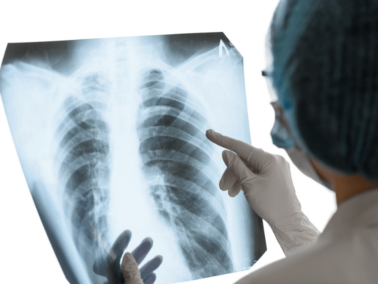 Pulmonology / Chest Diseases